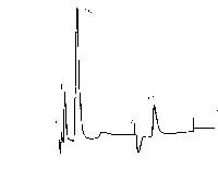 Ion chromatogram standard chlorate peak for method comparison